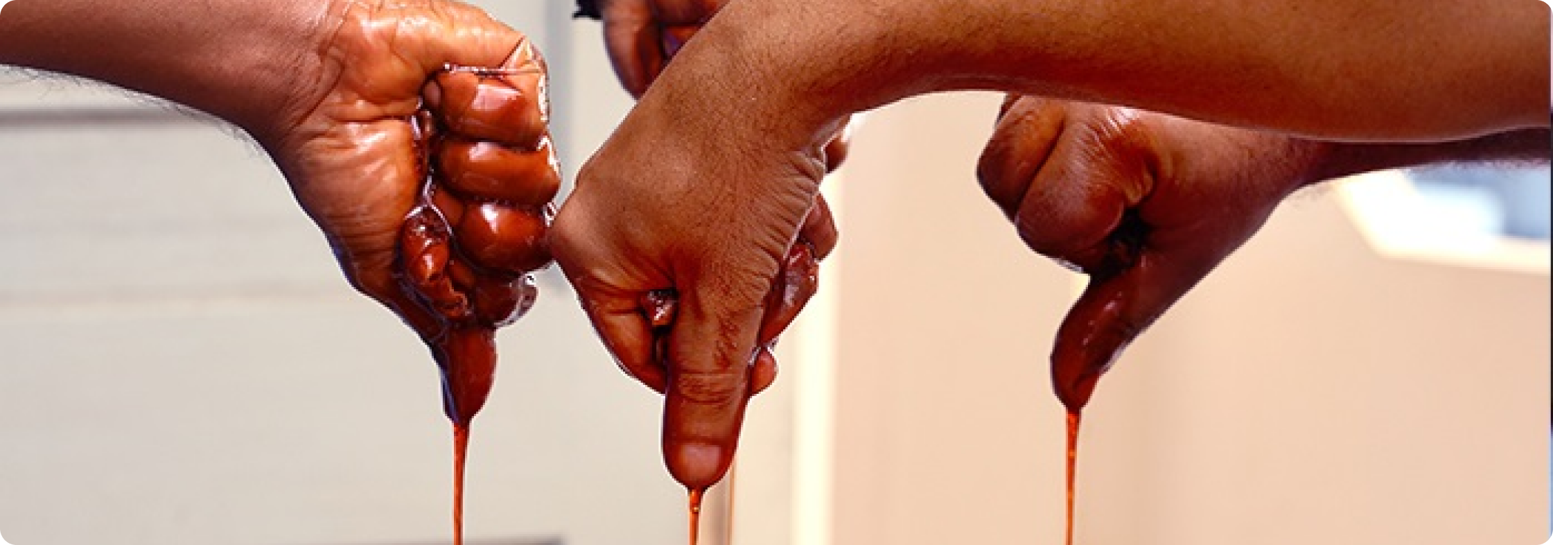 Pizhichil Ayurvedic Therapy